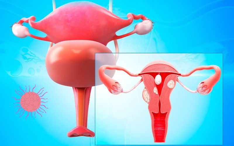 gynaecological cancer treatment in Delhi