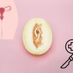 Hymenoplasty Surgery in Delhi