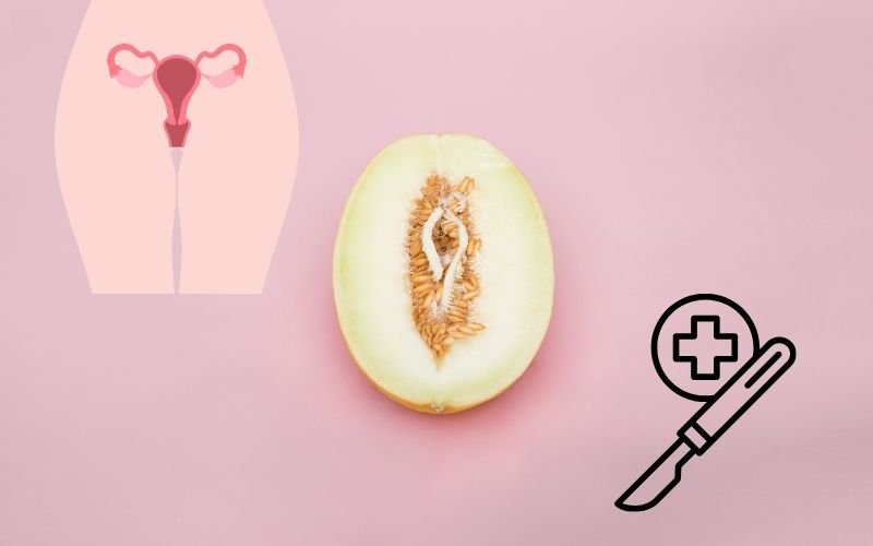 Hymenoplasty Surgery in Delhi